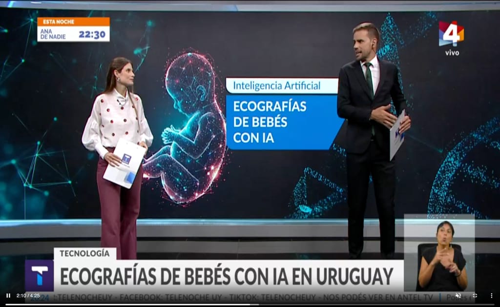 Beia Technology aparece en Telenoche por su innovación en ecografías hiperrealistas