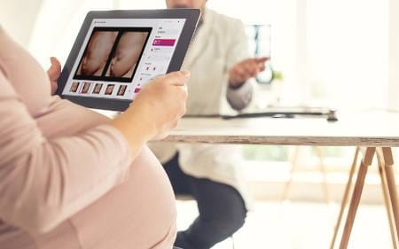 Mejorar la calidad de las ecografías: La clave para clínicas de fertilidad exitosas
