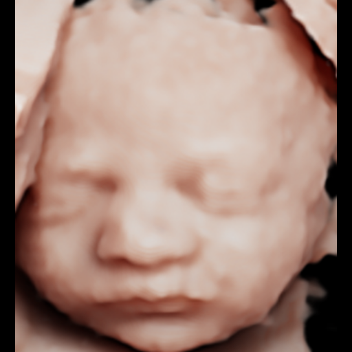 Ecografía original del rostro del bebé, ejemplo 05